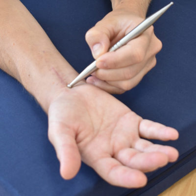 Behandlungsbeispiele Handtherapie